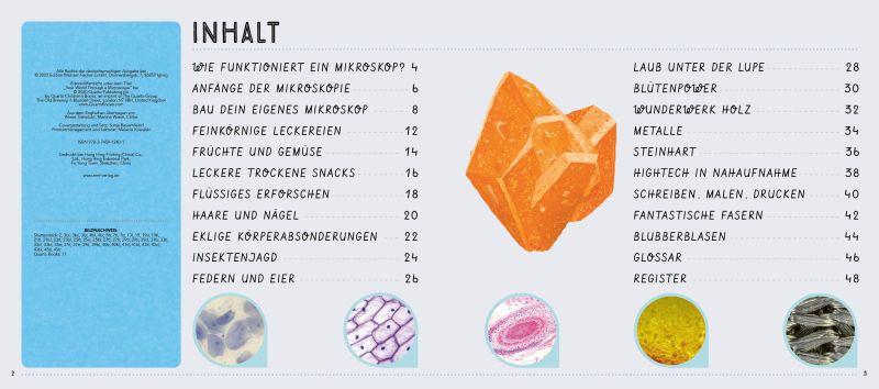 Das XXL-Entdecker-Set – Mikroskop: Mit Mikroskop, Linsen und Objektträgern + Sachbuch mit faszinierenden Experimenten